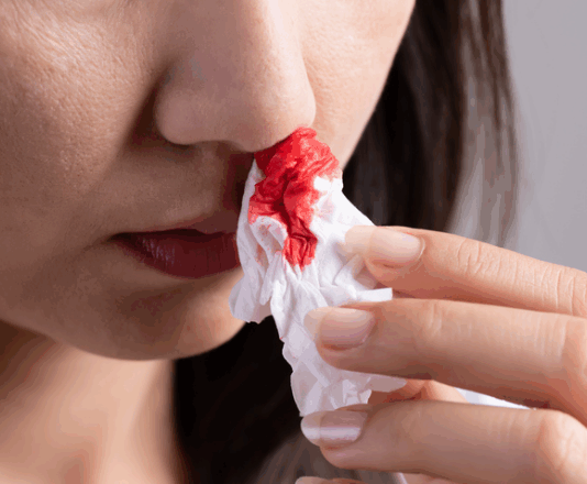 몸에서 피가 난다면…부위별 출혈이 알려주는 암의 적신호?